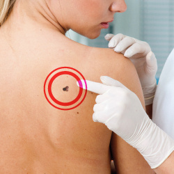 visita dermatologica e controllo nei